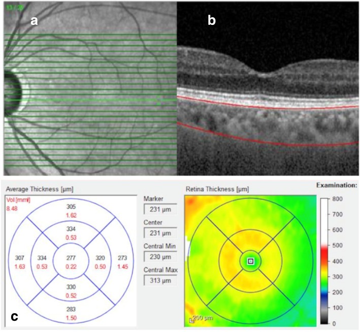 Fig. 1