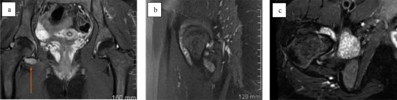Fig 2 –