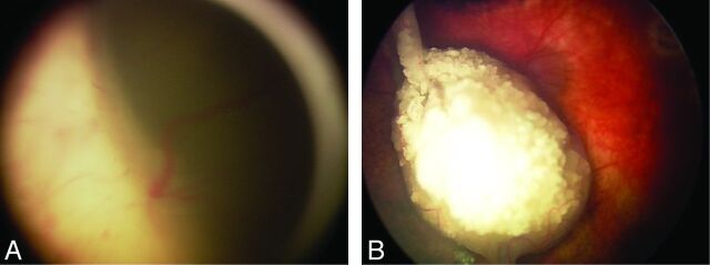 Fig 4.