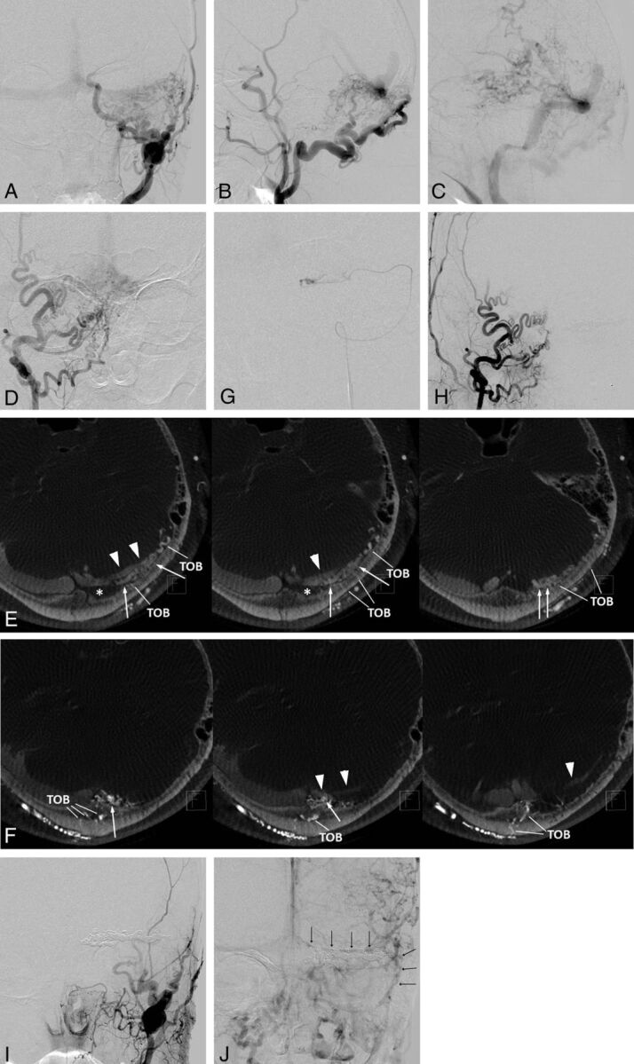 Fig 4.