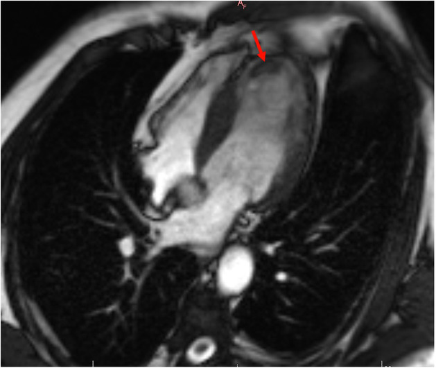 FIGURE 3