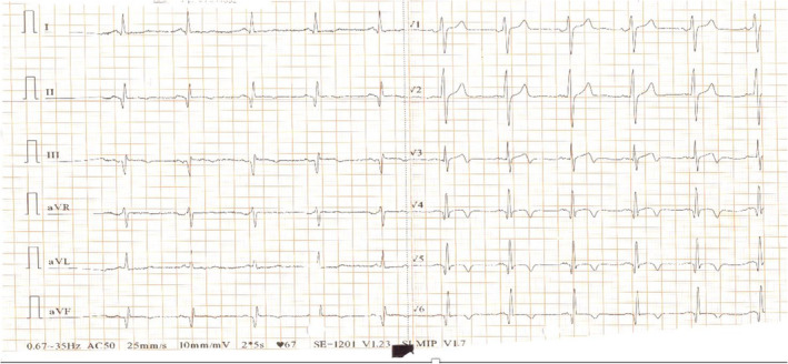 FIGURE 1