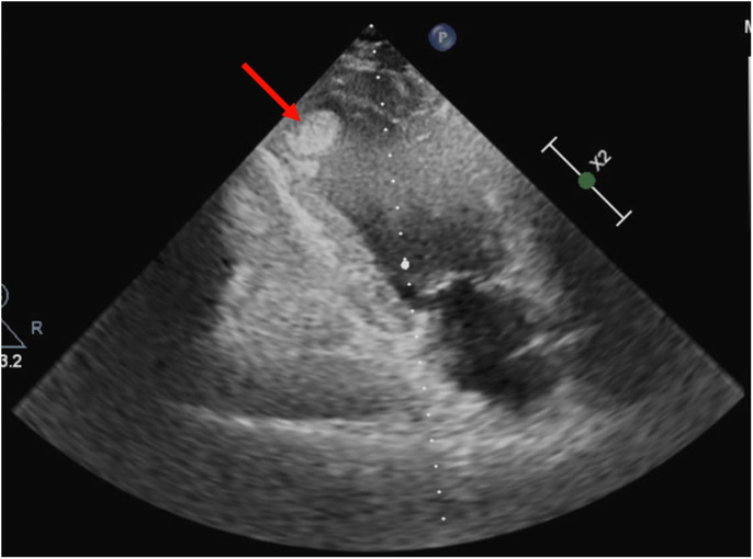 FIGURE 2