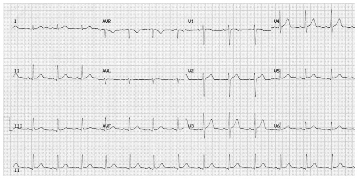 graphic file with name jetem-8-3-s34f2.jpg