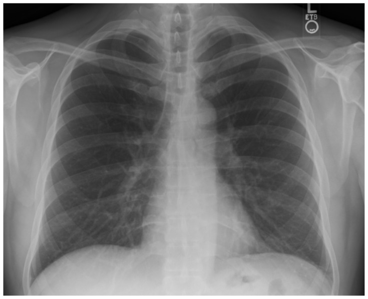 graphic file with name jetem-8-3-s34f1.jpg