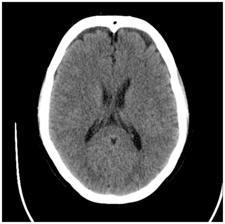 graphic file with name jetem-8-3-s34f3.jpg