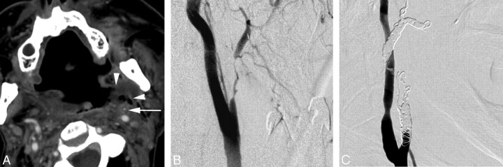 Fig 6.