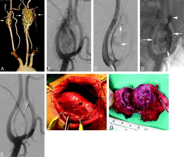 Fig 4.