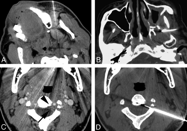 Fig 1.