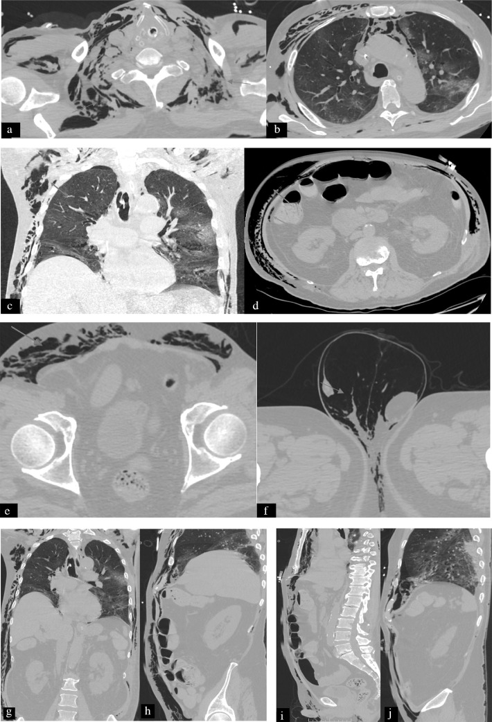 Fig 3