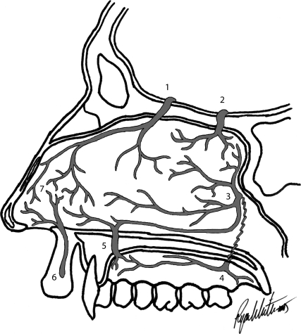 Blood supply of the nasal septum: (1) anterior ethmoidal artery, (2) posterior ethmoidal artery, (3) sphenopalatine artery, (4) greater (anterior division) and lesser (posterior division) palatine arteries, (5) greater palatine artery, (6) superior labial artery, and (7) Kiesselbach plexus.