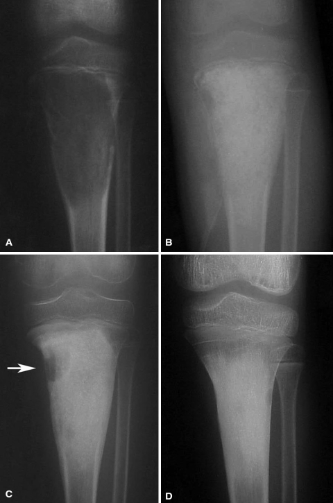 Fig. 3A–D