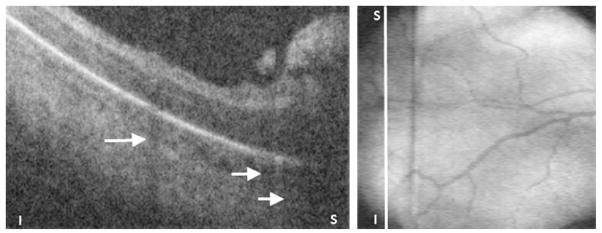 Fig. 17