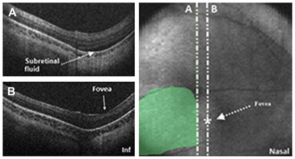 Fig. 18