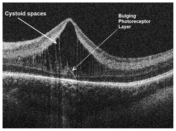 Fig. 14