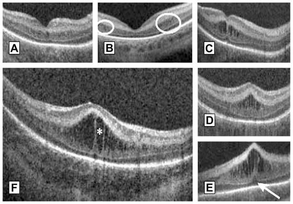 Fig. 15