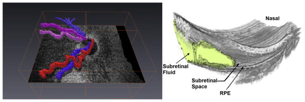 Fig. 21