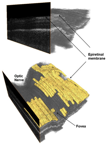 Fig. 13