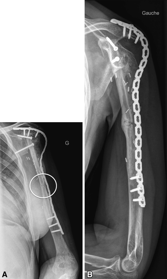 Fig. 5A–B