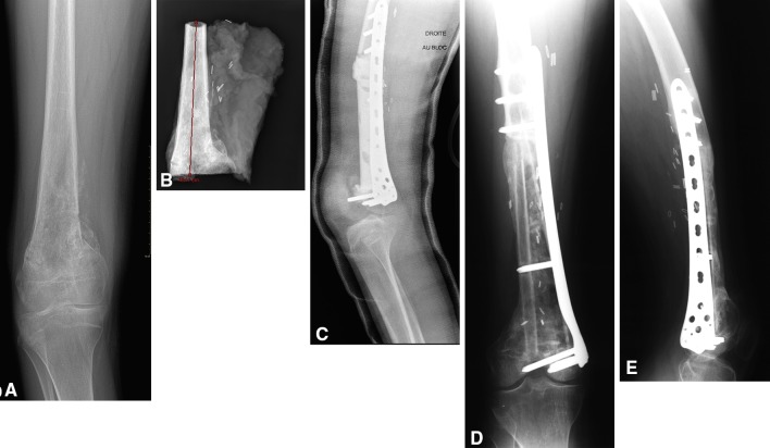 Fig. 2A–E