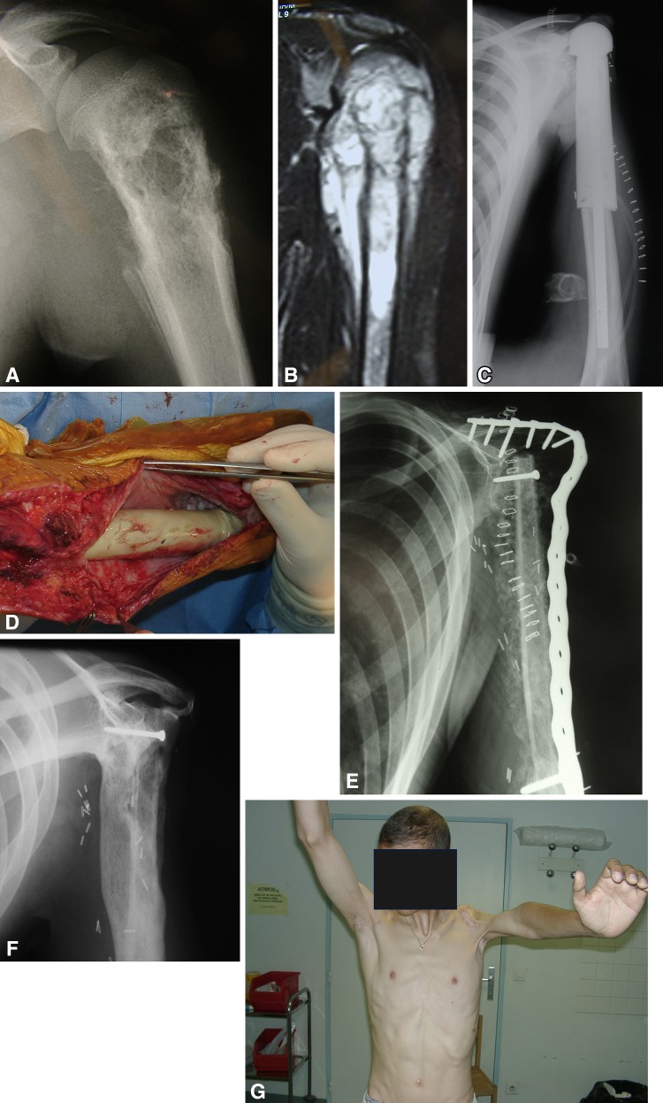 Fig. 1A–G