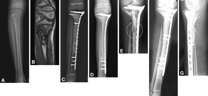 Fig. 4A–G