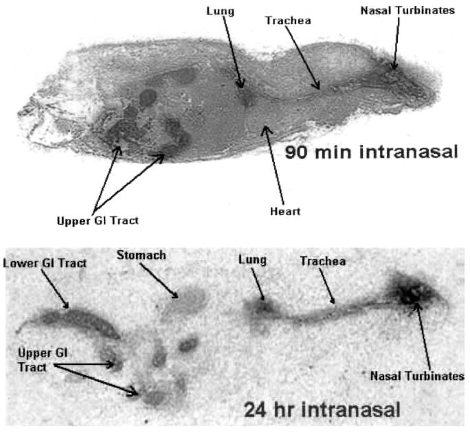 FIG. 1