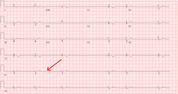 FIGURE 1