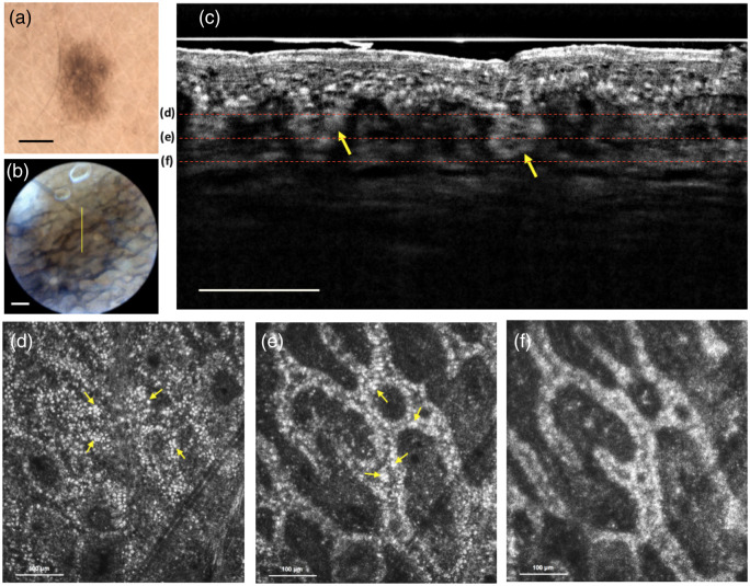 Fig. 3