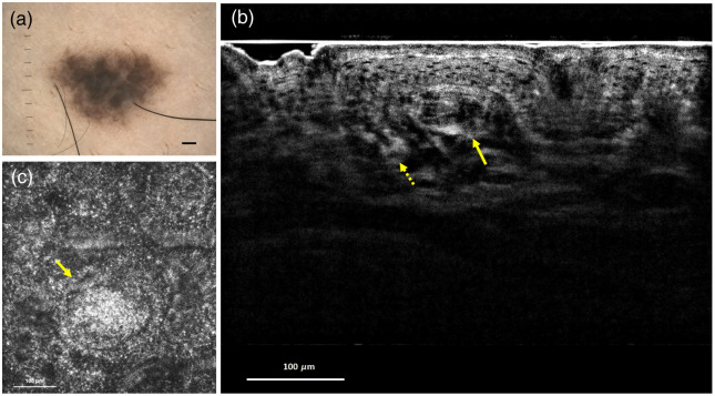 Fig. 4