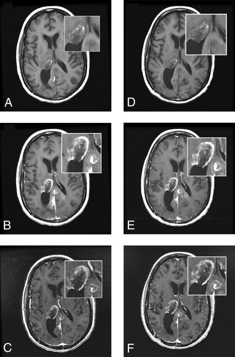 Fig 4.