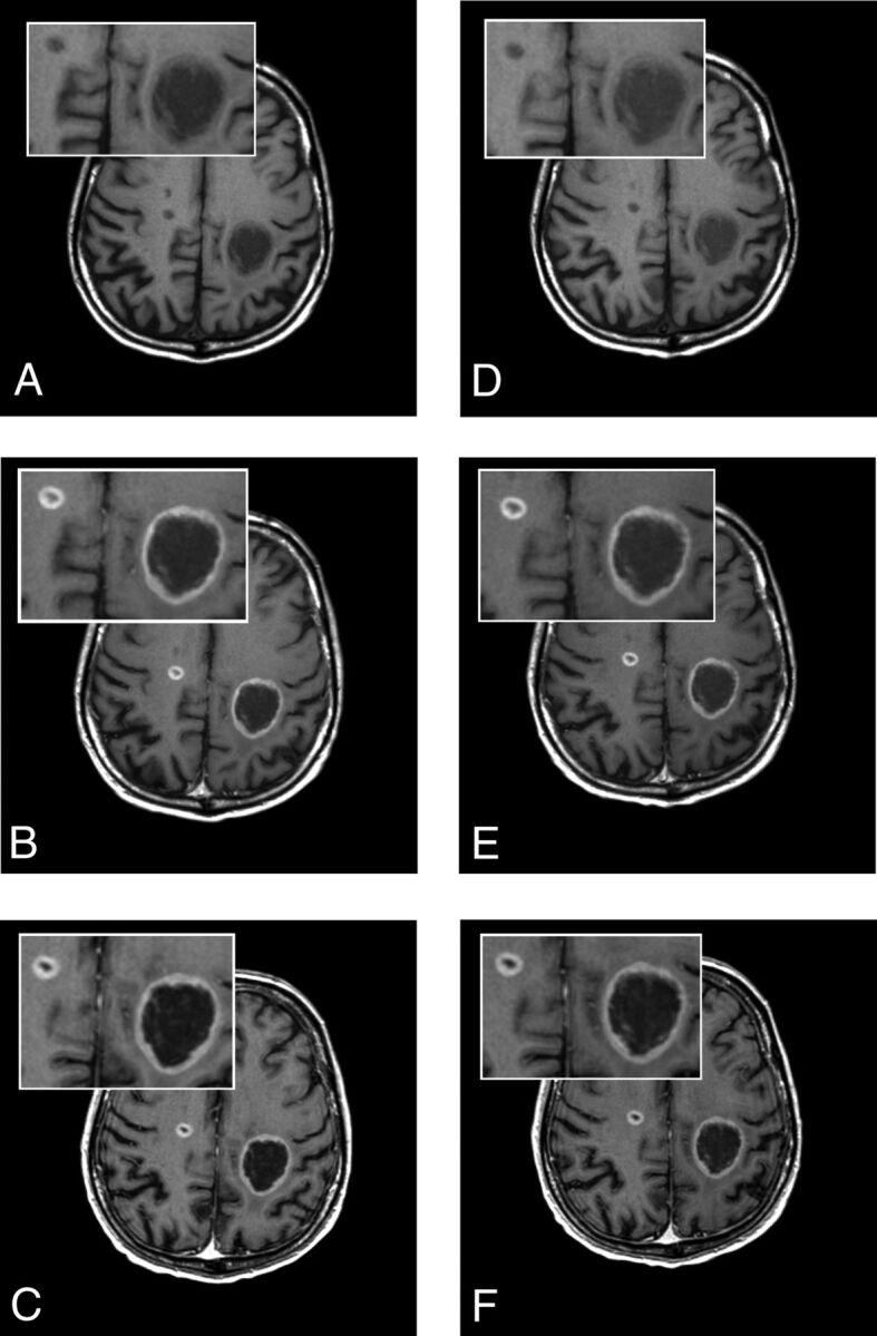 Fig 3.