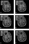 Fig 3.