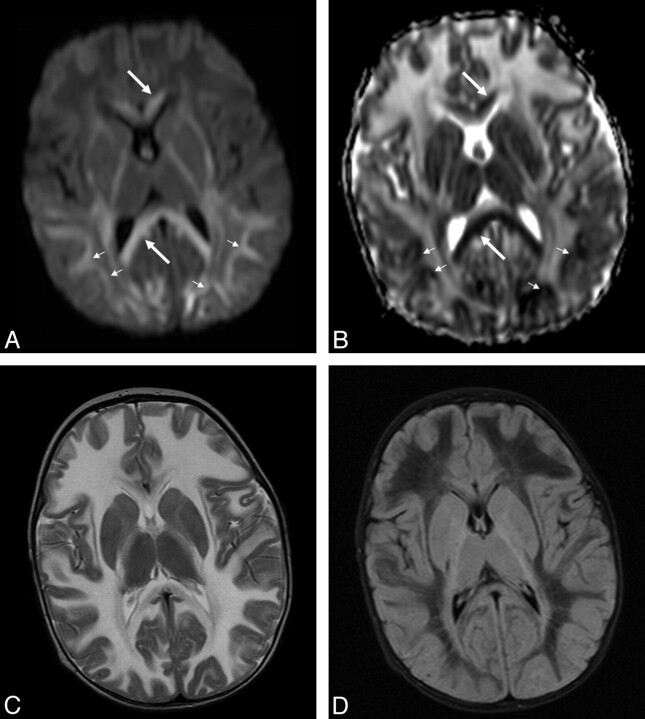 Fig 3.