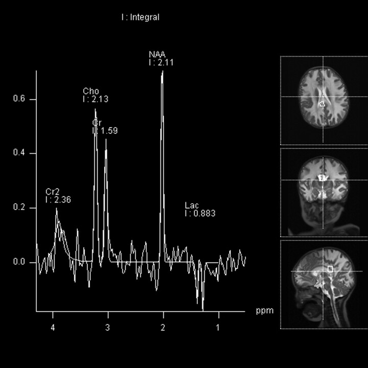 Fig 4.