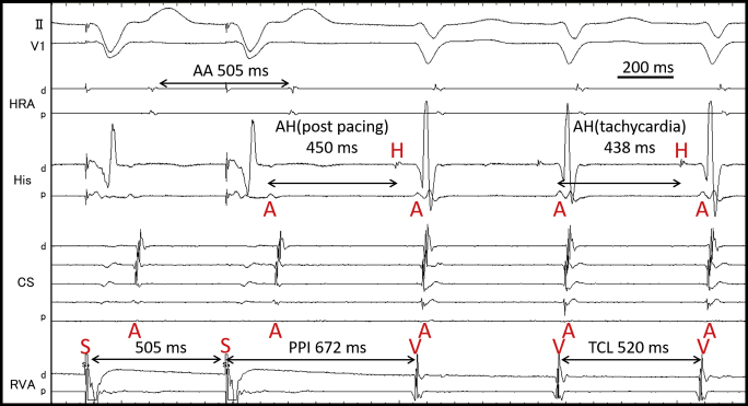 Supplementary Figure 1