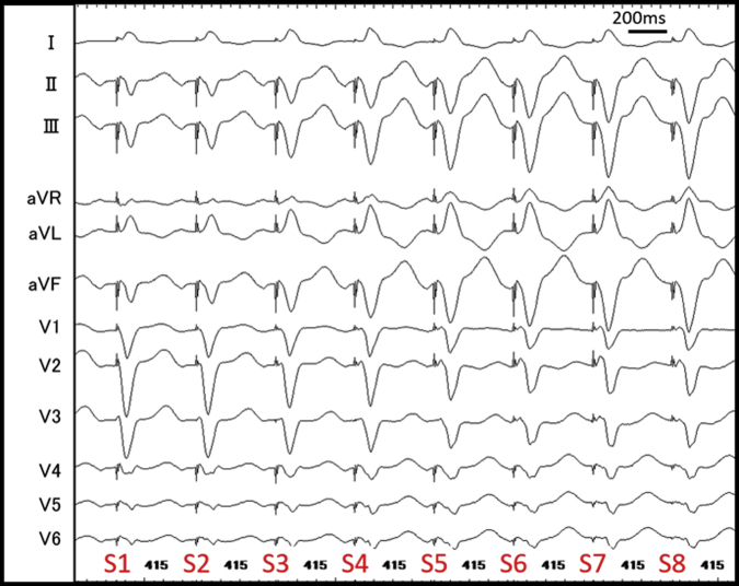 Supplementary Figure 3