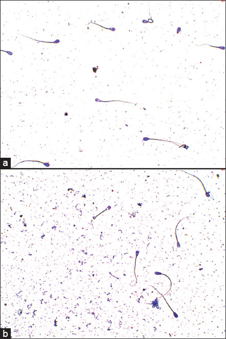 Figure-4