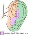 Fig 3: