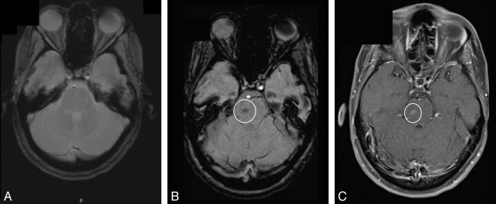 Fig 1.