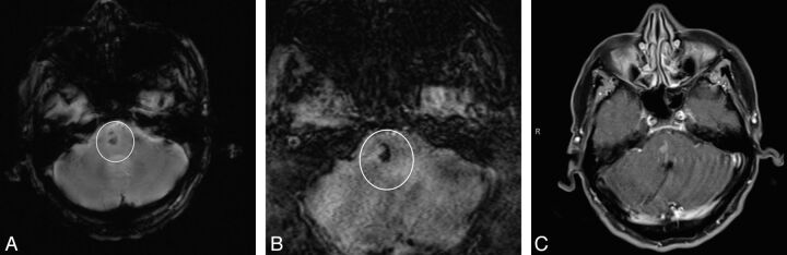 Fig 3.