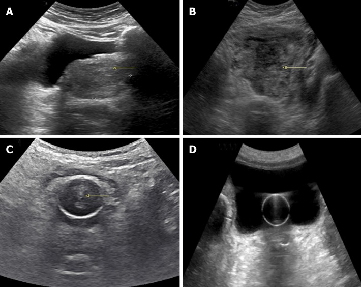 Figure 13