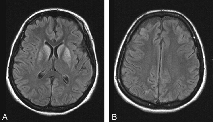 Fig 3.