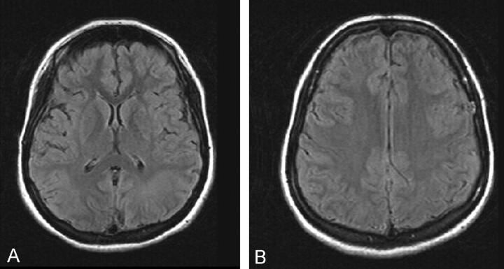 Fig 1.