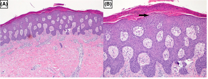 FIGURE 3