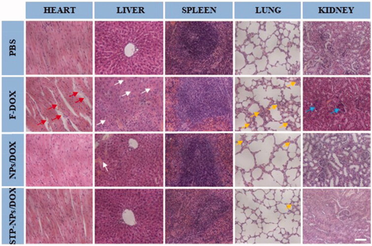 Figure 12.