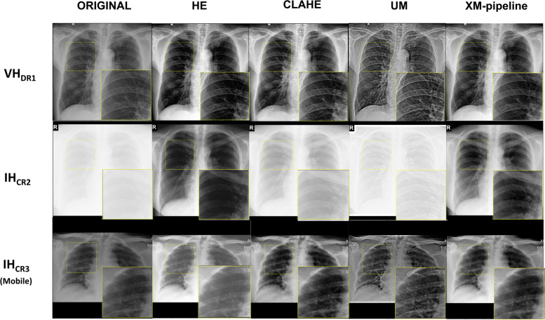 Fig. 4