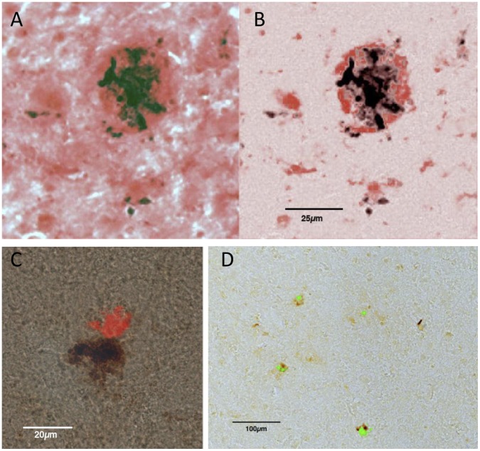 Figure 11