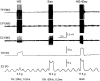 Figure 11.