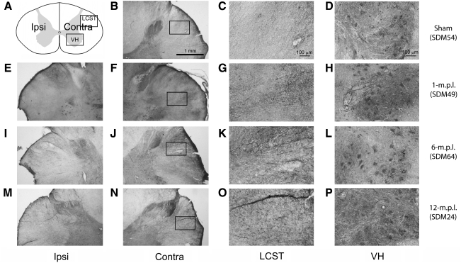 FIG. 11.